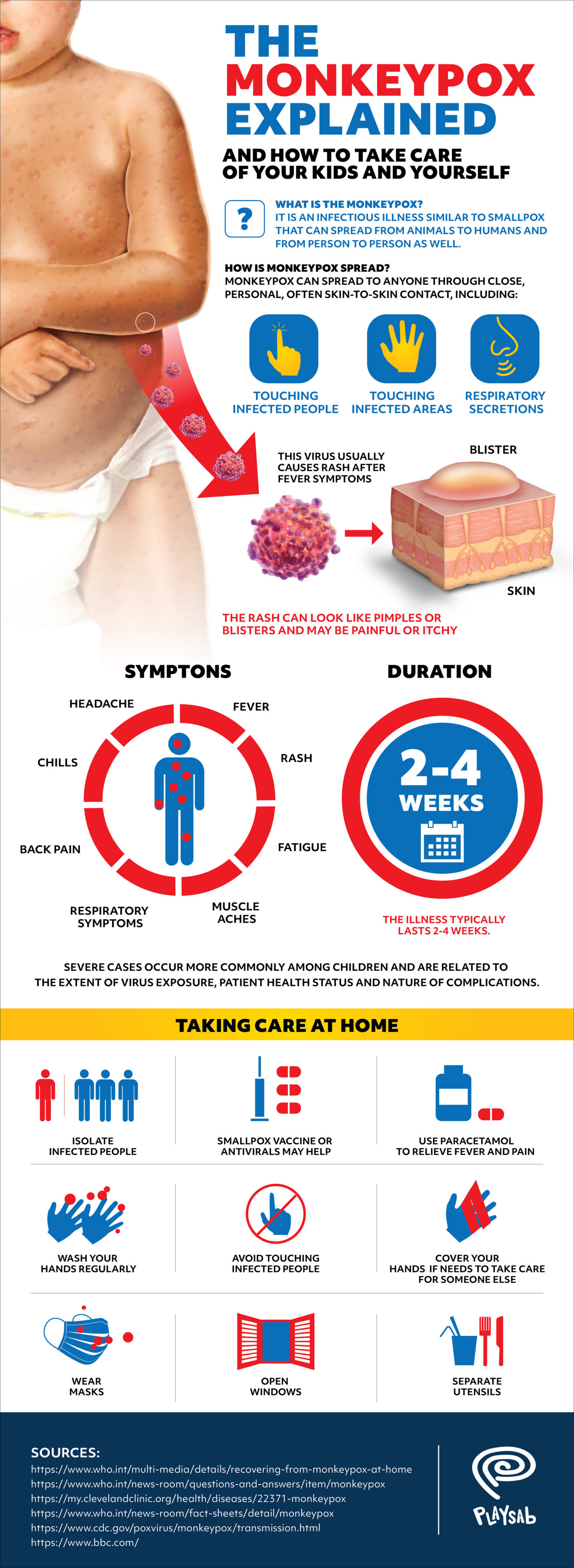 Monkeypox Infographic